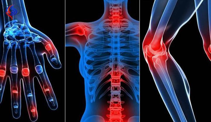 POMMADE POUR LES DOULEURS ARTICULAIRES - ديزر علاج مفاصل